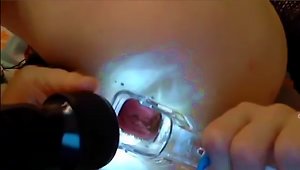 Russian Girl In Webcam With Anal Speculum